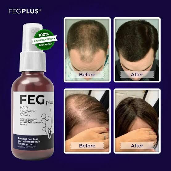 FEG Plus Fast Hair Growth Spray          بخاخ FEG Plus لنمو الشعر السريع